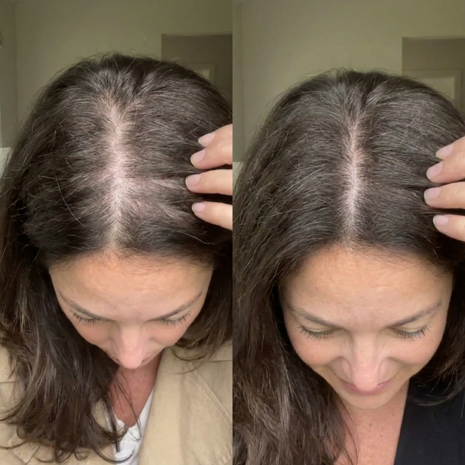 Scalp Activating Serum