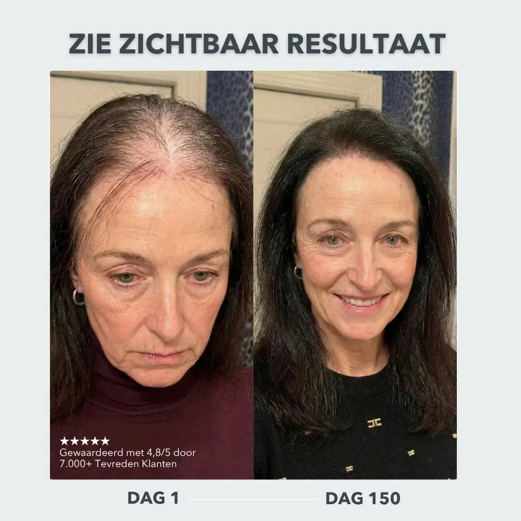 Scalp Activating Serum