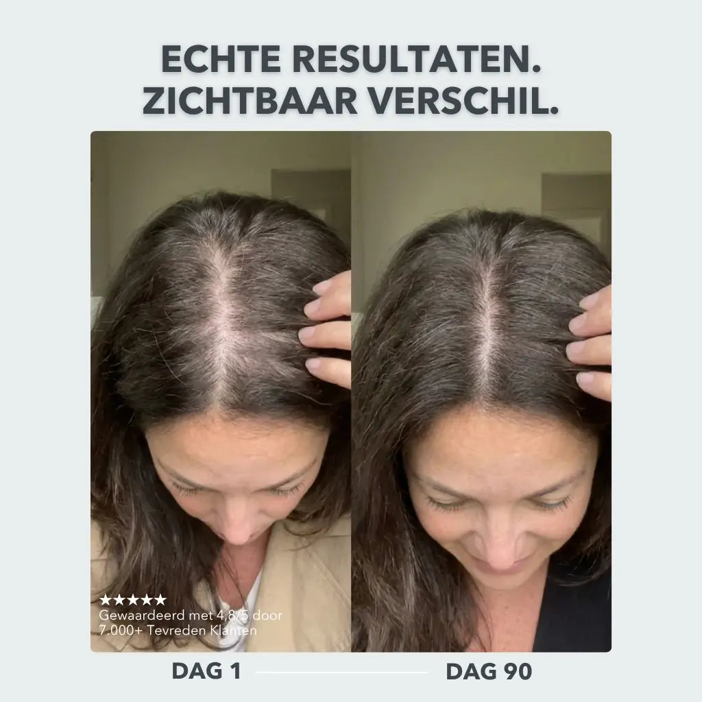 Scalp Activating Serum