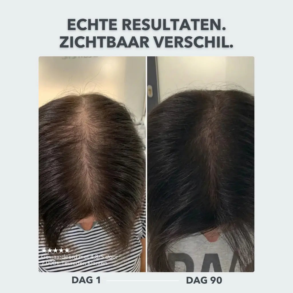 Scalp Activating Serum